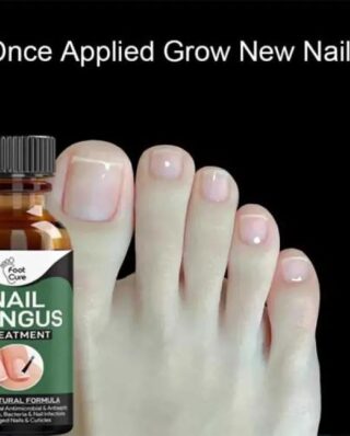 Nail Fungus (10 ML)
